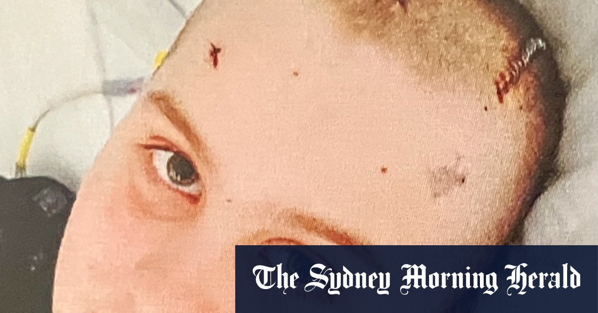 The surreal moment this man seen a piece of his brain in a bank